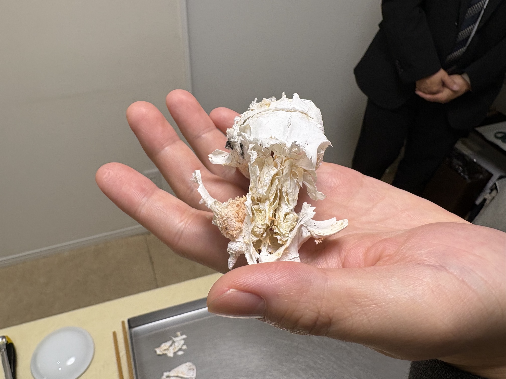 やはり腫瘍で頭蓋骨の半分が溶けていた